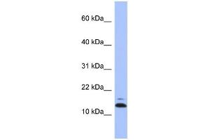 WB Suggested Anti-ASAH1 Antibody Titration: 0. (ASAH1 antibody  (N-Term))
