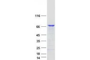 Validation with Western Blot (C2orf63 Protein (Transcript Variant 1) (Myc-DYKDDDDK Tag))
