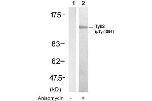 Image no. 1 for anti-Tyrosine Kinase 2 (TYK2) (pTyr1054) antibody (ABIN319229) (TYK2 antibody  (pTyr1054))