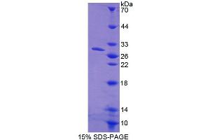 SDS-PAGE (SDS) image for Calcineurin-Like phosphoesterase Domain Containing 1 (Cpped1) (AA 7-229) protein (His tag) (ABIN6239539) (Cpped1 Protein (AA 7-229) (His tag))