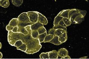 Immunofluorescent staining of WIDR cells at 1:50 dilution of E-cadherin. (E-cadherin antibody  (C-Term))