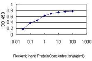 Detection limit for recombinant GST tagged BRRN1 is approximately 0. (NCAPH antibody  (AA 645-741))