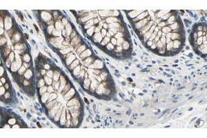 ABIN6273041 at 1/100 staining Rat colon tissue by IHC-P. (DIAPH3 antibody  (Internal Region))