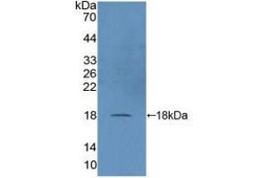 Western blot analysis of recombinant Human DUSP5.