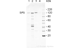Western Blotting (WB) image for anti-SPS antibody (ABIN5706929) (SPS antibody)