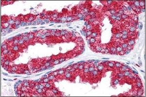 Immunohistochemistry of EMX2 in Human Prostate tissue with EMX2 Antibody  at 5 μg/ml. (EMX2 antibody  (N-Term))