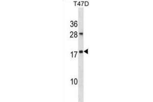 Western Blotting (WB) image for anti-ADP-Ribosylation Factor-Like 2 (ARL2) antibody (ABIN2998892) (ARL2 antibody)