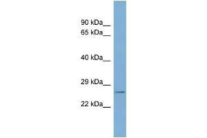 WB Suggested Anti-WBP2 Antibody Titration: 0. (WBP2 antibody  (N-Term))