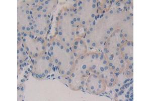 Used in DAB staining on fromalin fixed paraffin- embedded kidney tissue (Secernin 1 antibody  (AA 2-414))