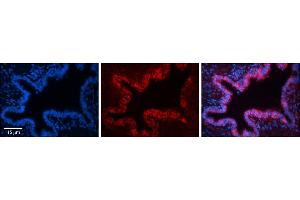 Rabbit Anti-SQLE Antibody     Formalin Fixed Paraffin Embedded Tissue: Human Bronchial Epithelial Tissue  Observed Staining: Cytoplasmic  Primary Antibody Concentration: 1:100  Other Working Concentrations: 1/600  Secondary Antibody: Donkey anti-Rabbit-Cy3  Secondary Antibody Concentration: 1:200  Magnification: 20X  Exposure Time: 0. (SQLE antibody  (C-Term))