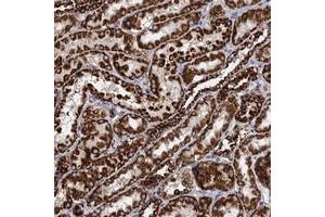 Immunohistochemical staining of human kidney with TIMM10 polyclonal antibody  shows strong cytoplasmic positivity in cells in tubules at 1:50-1:200 dilution.