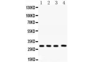 Western Blotting (WB) image for anti-Carbonic Anhydrase I (CA1) (AA 9-261) antibody (ABIN3043766) (CA1 antibody  (AA 9-261))