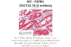 Image no. 1 for anti-Fibroblast Growth Factor Receptor 4 (FGFR4) antibody (ABIN2851987) (FGFR4 antibody)