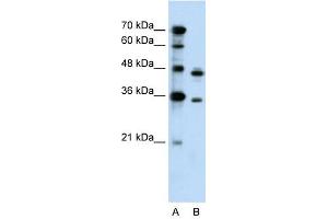 PRPS2 antibody used at 0. (PRPS2 antibody  (Middle Region))