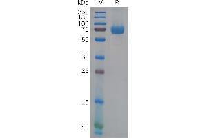 Human E Protein, His Tag on SDS-PAGE under reducing condition.
