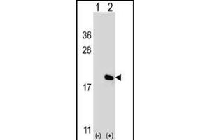 Western blot analysis of IL17A (arrow) using rabbit polyclonal IL17A Antibody (Center) (ABIN656842 and ABIN2846049). (Interleukin 17a antibody  (AA 61-87))