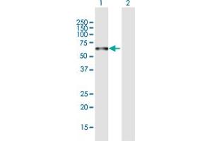 PLEKHO2 anticorps  (AA 1-440)
