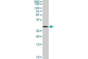 PLP1 MaxPab rabbit polyclonal antibody. (PLP1 antibody  (AA 1-277))