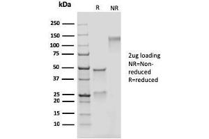 SDS-PAGE Analysis Purified Adipophilin Recombinant Mouse Monoclonal Antibody (rADFP/1493). (Recombinant ADRP antibody  (AA 249-376))