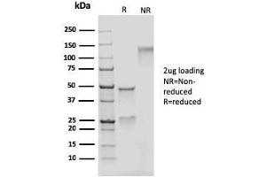 SDS-PAGE Analysis Purified Adipophilin Recombinant Mouse Monoclonal Antibody (rADFP/1493).