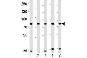Western blot analysis of lysate from 1) A549, 2) HeLa, 3) MCF-7, 4) SH-SY5Y and 5) SW480 cell lines using Insulin Receptor Related antibody at 1:1000.