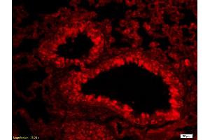 Formalin-fixed and paraffin-embedded rat lung labeled with Anti-Aggrecan Polyclonal Antibody, Unconjugated (ABIN1386175) 1:200, overnight at 4°C, The secondary antibody was Goat Anti-Rabbit IgG, Cy3 conjugated used at 1:200 dilution for 40 minutes at 37°C. (Aggrecan antibody  (AA 601-700))