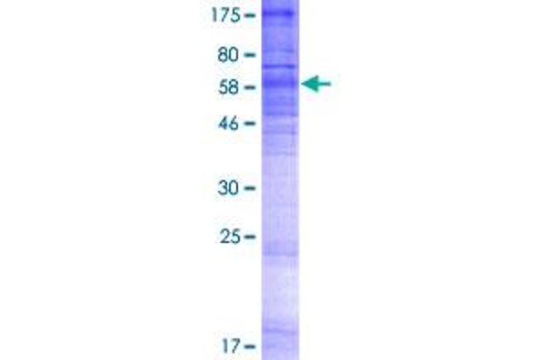 S1PR3 Protein (AA 1-378) (GST tag)