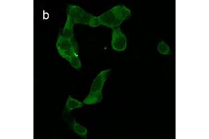 Detection of cathepsin B (CB) activity in Eca-109 cells by the CB probe. (Goat anti-Rabbit IgG Antibody (FITC))