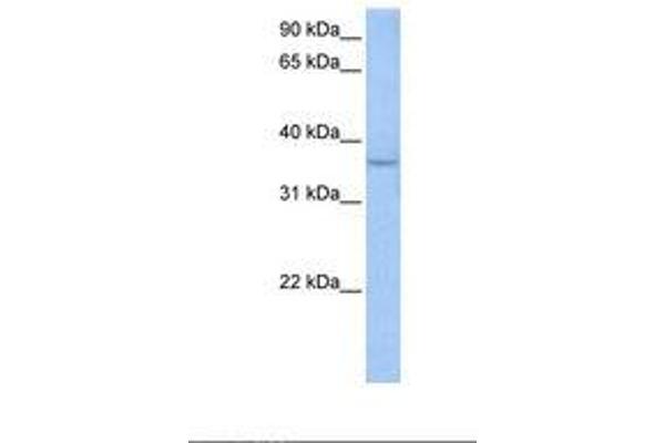 ACPT antibody  (AA 291-340)