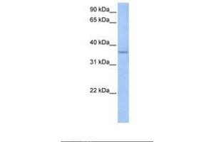 Image no. 1 for anti-Acid Phosphatase, Testicular (ACPT) (AA 291-340) antibody (ABIN6738680)