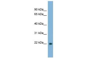 WB Suggested Anti-LBX2 Antibody Titration:  0. (LBX2 antibody  (Middle Region))