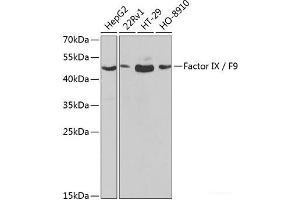 Western blot analysis of extracts of various cell lines using Factor IX / F9 Polyclonal Antibody at dilution of 1:1000. (Coagulation Factor IX antibody)