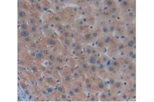 DAB staining on IHC-P; Samples: Human Liver Tissue (MSTN antibody  (AA 267-375))