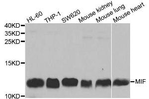 Western blot analysis of extracts of various cell lines, using MIF antibody. (MIF antibody  (AA 1-115))