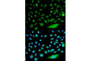 Immunofluorescence (IF) image for anti-SMAD, Mothers Against DPP Homolog 1 (SMAD1) (AA 20-240) antibody (ABIN3021439) (SMAD1 antibody  (AA 20-240))