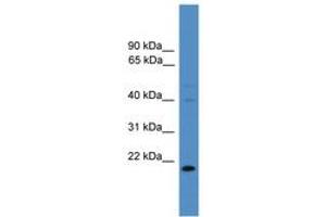 Image no. 1 for anti-TIMP Metallopeptidase Inhibitor 3 (TIMP3) (N-Term) antibody (ABIN6745331) (TIMP3 antibody  (N-Term))