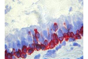Immunohistochemistry (IHC) image for anti-Basal Membrane antibody (ABIN781795) (Basal Membrane antibody)