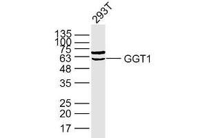 Lane 1: 293T lysates probed with GGT1 Polyclonal Antibody, Unconjugated (bs-2976R) at 1:300 overnight at 4˚C. (GGT1 antibody  (AA 351-460))