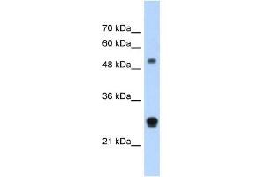 WB Suggested Anti-IGSF1 Antibody Titration:  1.