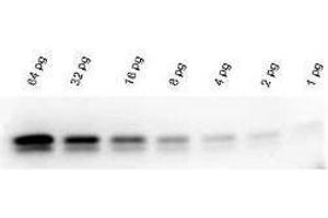 Western Blotting (WB) image for Western Blot Kit Chemiluminescent Western Blot Kit for use with Human Primary Antibody FemtoMax (ABIN965410)
