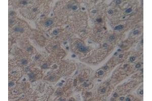 Detection of APAF1 in Human Liver Tissue using Polyclonal Antibody to Apoptotic Peptidase Activating Factor 1 (APAF1) (APAF1 antibody  (AA 31-350))