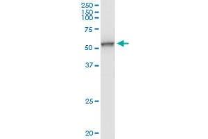 UGP2 MaxPab rabbit polyclonal antibody. (UGP2 antibody  (AA 1-508))