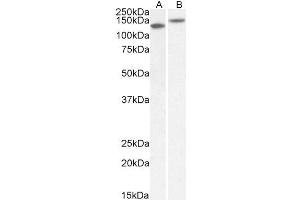 ABIN1781839 (1µg/ml) staining of Mouse (A) and Rat (B) Brain lysate (35µg protein in RIPA buffer). (Contactin 1 antibody  (AA 585-870))