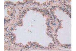 Figure. (LOXL2 antibody  (AA 544-751))