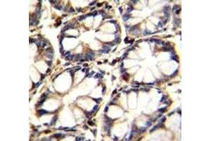Immunohistochemistry (IHC) image for anti-Tumor Necrosis Factor Receptor Superfamily, Member 1A (TNFRSF1A) (AA 17-43) antibody (ABIN3029363)