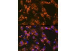 Immunofluorescence analysis of C6 cells using  Rabbit mAb (ABIN1681069, ABIN3018897, ABIN3018898 and ABIN7101684) at dilution of 1:100 (40x lens). (alpha Adaptin antibody)