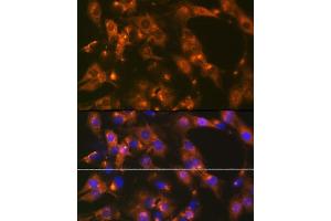 Immunofluorescence analysis of C6 cells using  Rabbit mAb (ABIN1681069, ABIN3018897, ABIN3018898 and ABIN7101684) at dilution of 1:100 (40x lens). (alpha Adaptin antibody)