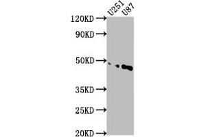 Western Blot Positive WB detected in: U251 whole cell lysate, U87 whole cell lysate All lanes: OTUD3 antibody at 1:1000 Secondary Goat polyclonal to rabbit IgG at 1/50000 dilution Predicted band size: 46 kDa Observed band size: 46 kDa (OTUD3 antibody  (AA 108-398))