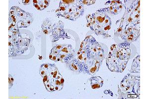 Formalin-fixed and paraffin embedded human placenta tissue labeled with Anti-Cyclin D1 Polyclonal Antibody, unconjugated  (ABIN671016)  at 1: 200, followed by incubation with conjugated secondary antibody and DAB staining (Cyclin D1 antibody  (AA 61-110))