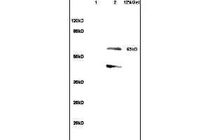 Lane 1: rat heart lysates Lane 2: rat brain lysates probed with Anti SHC3 Polyclonal Antibody, Unconjugated (ABIN715661) at 1:200 in 4 °C. (SHC3 antibody  (AA 501-594))